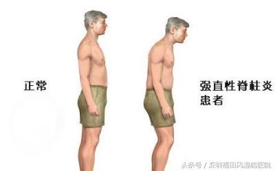 新一轮寒冷空气来袭，您有一份来自深圳市福田区风湿病专科医院的健康宝典，请查收~